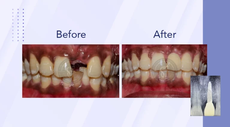 F&F Dental Website services banner resize_phone size-01