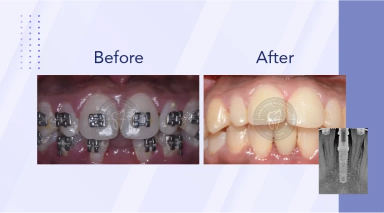 F&F Dental Website services banner resize_phone size-02