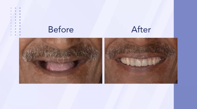 F&F Dental Website services banner resize_phone size-04