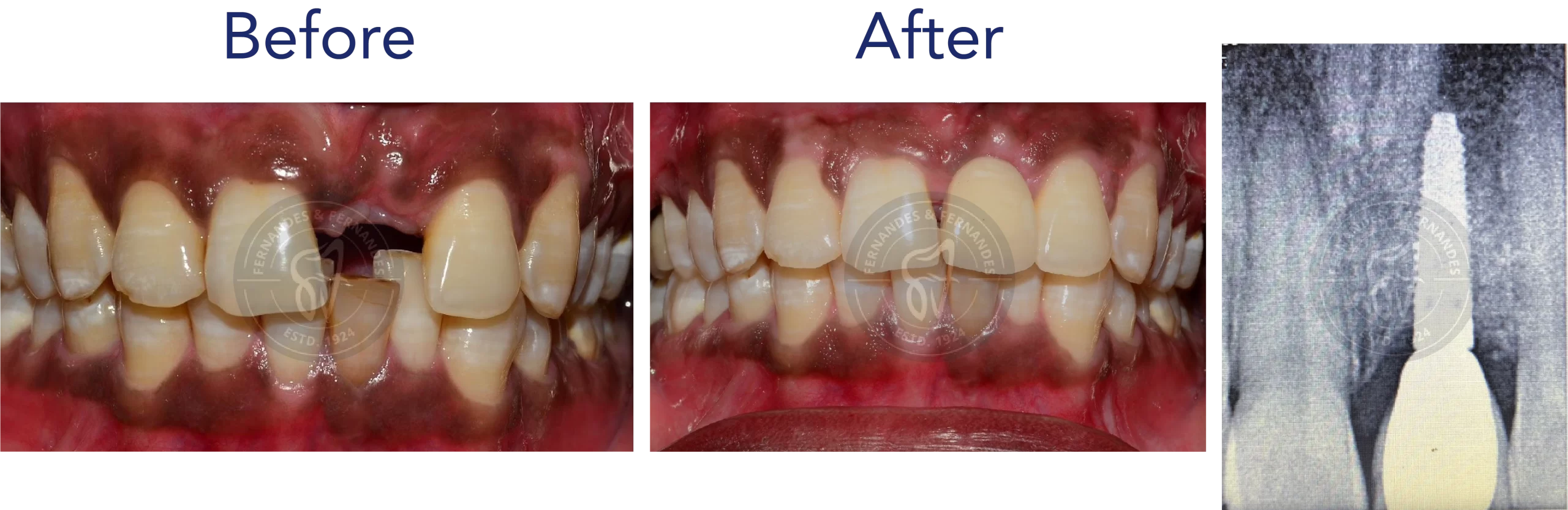 F&F Dental Website services_desktop size-15