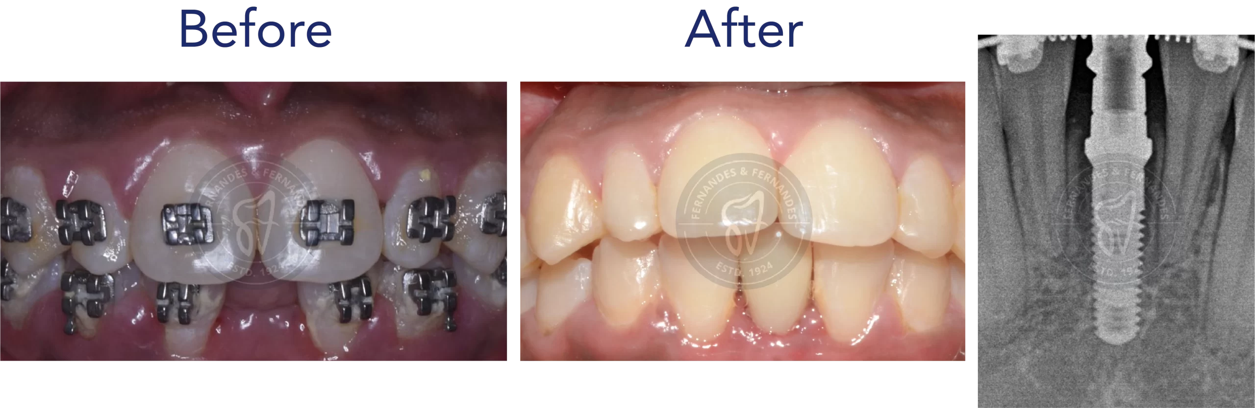 F&F Dental Website services_desktop size-16