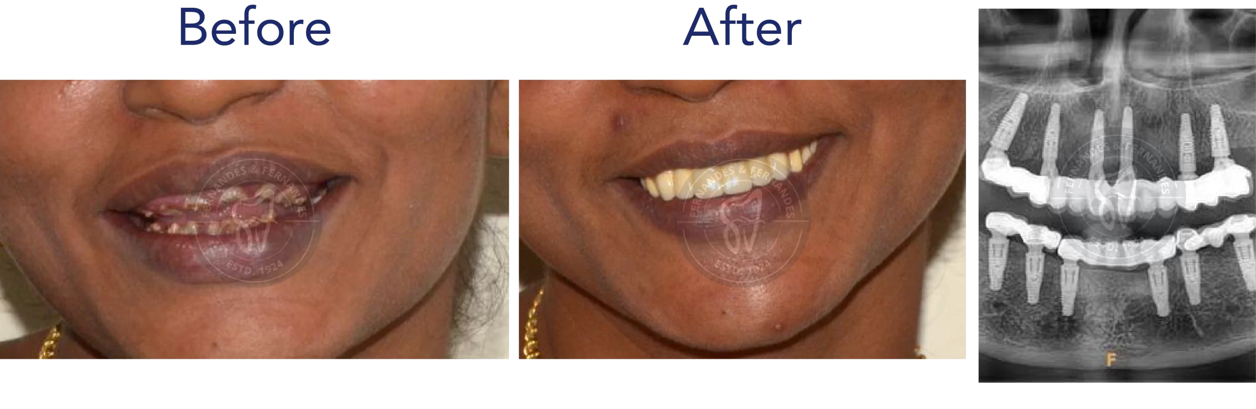 F&F Dental Website services_desktop size-17