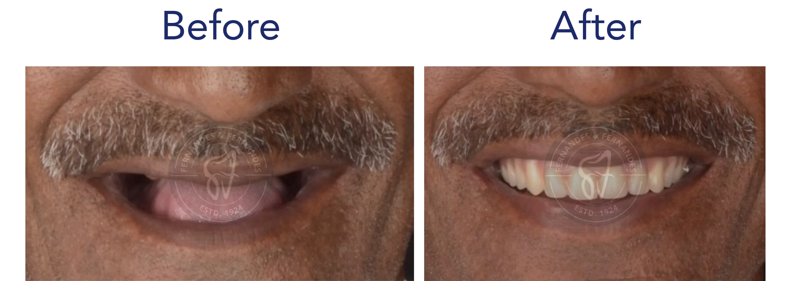 F&F Dental Website services_desktop size-18
